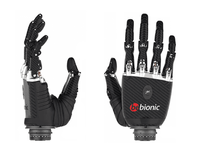 Desire This | bebionic3 RSLSteeper
