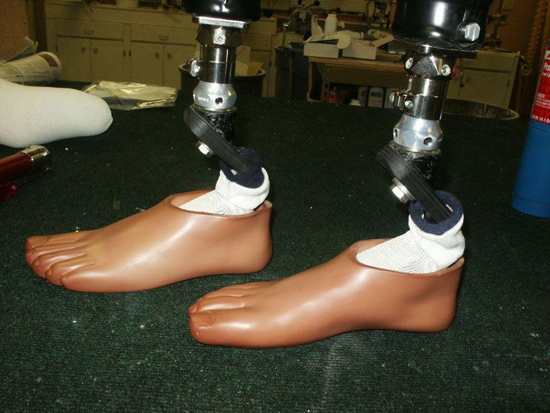 Prosthetic Feet at Rs 35000/unit | प्रोस्थेटिक फुट - Quality Artficial ...