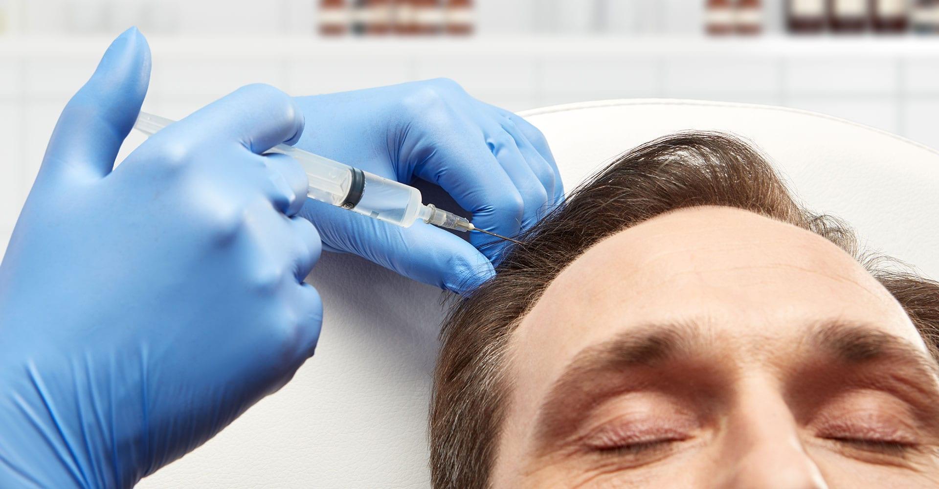 Non-Surgical Hair Restoration: Understanding the Basics of PRP Therapy ...