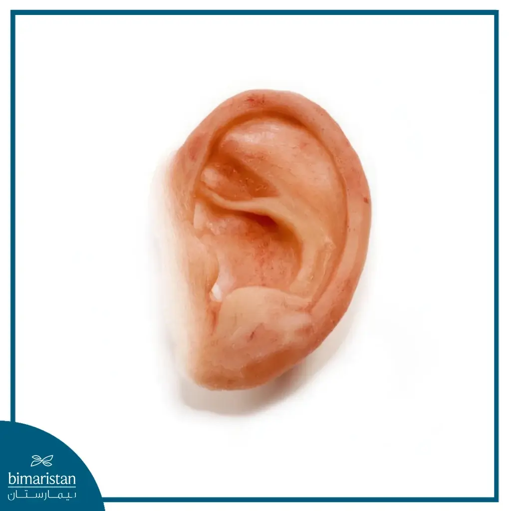 Silicone Prosthetics: The Future of Aesthetic - Bimaristan