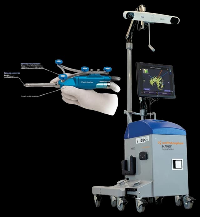 Navio Surgical System | Oswego Health