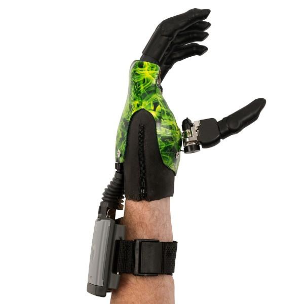 EASTIN - i-digits quantum - Touch Bionics GmbH - Prosthetic hands and ...