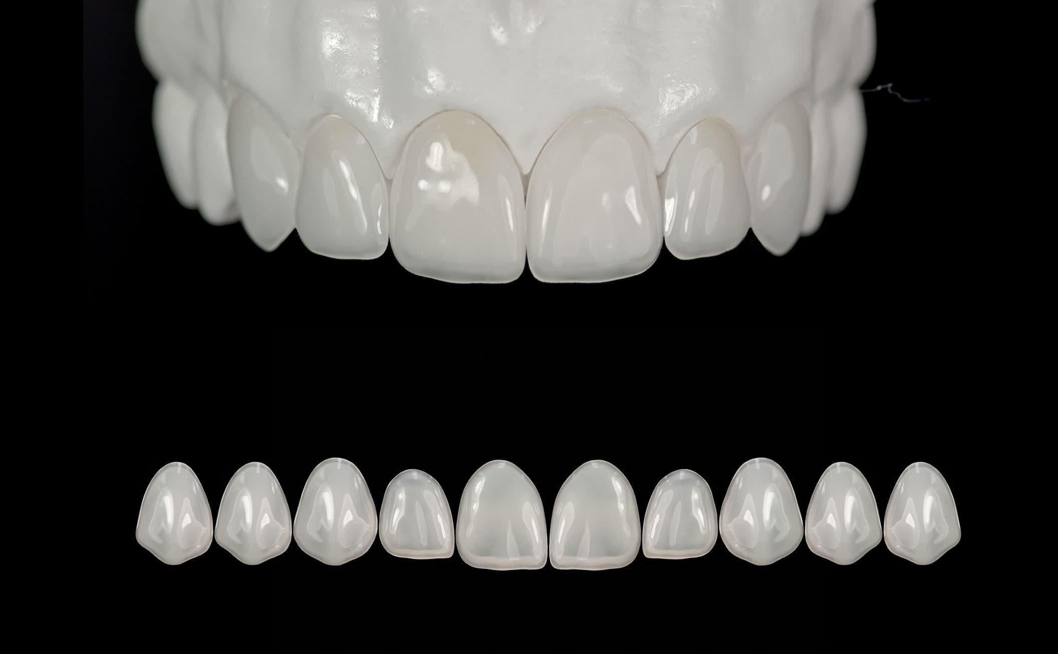 Edelweiss Veneers 🦷 | Dental, Aesthetic dentistry, Dental photography