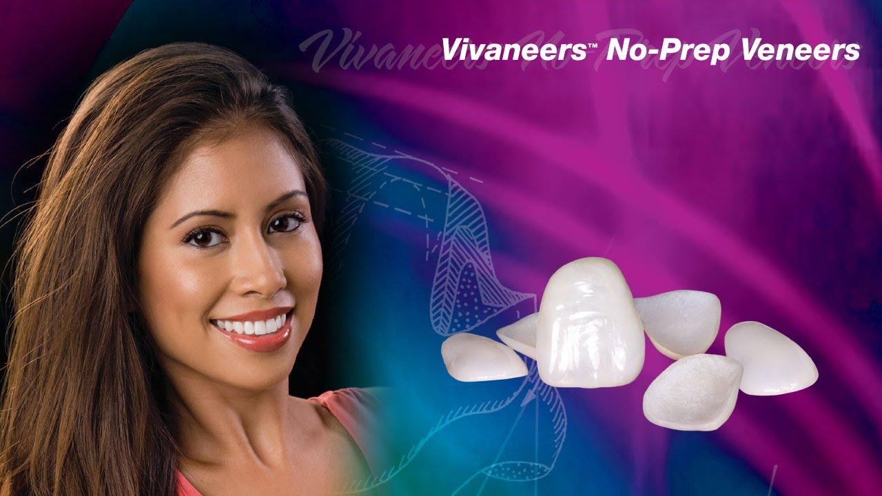 Vivaneers™ No-Prep Veneers - YouTube