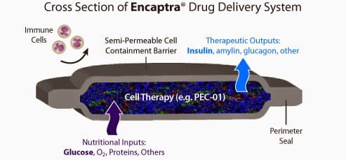 Diabetes Stem Cell Milestone: ViaCyte Transplants 1st Patient - The Niche