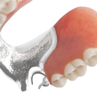 FlexiLytes Combo Flexible Partial Dentures | Aspen Dental