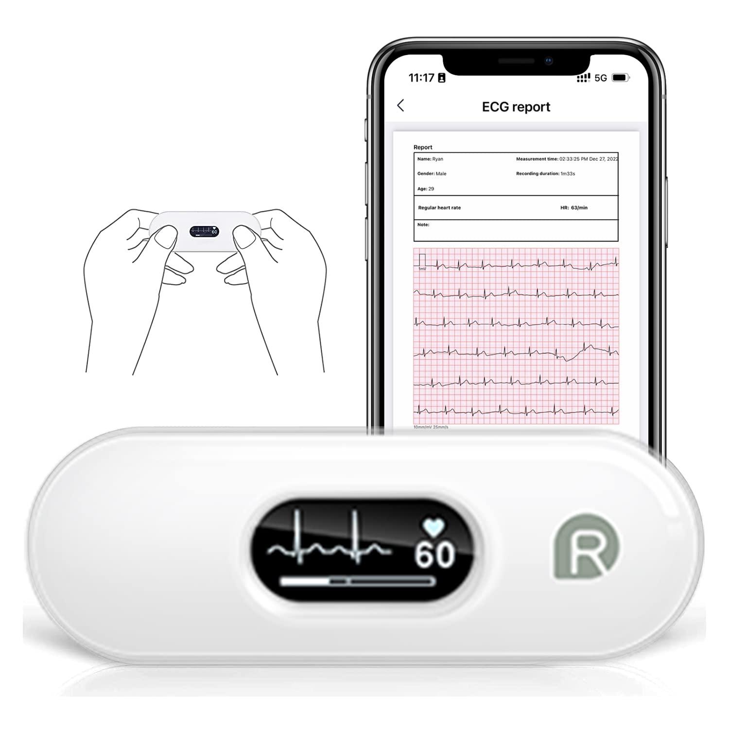 Wellue DuoEK-S Personal ECG Monitor, Bluetooth Wireless Portable Heart ...