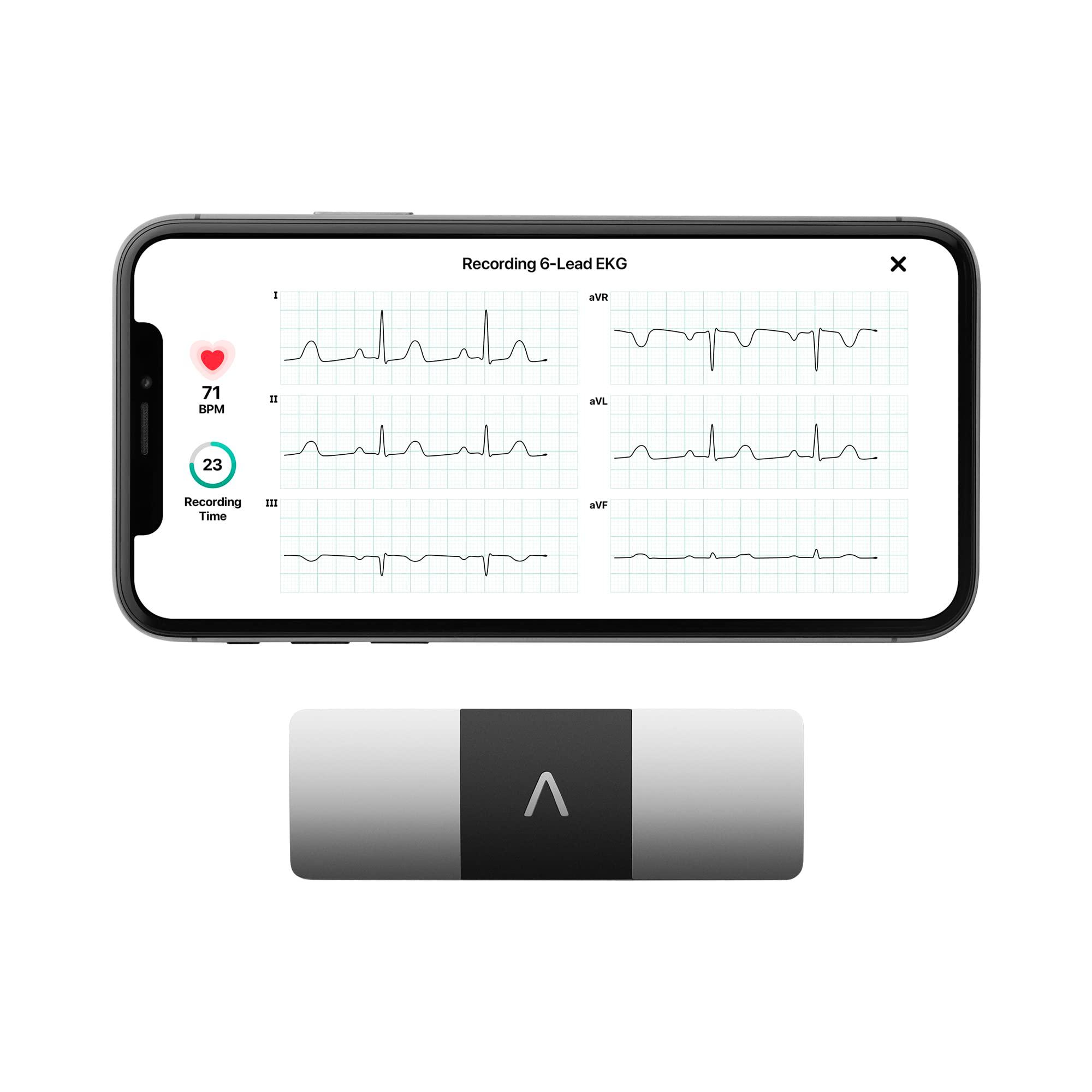 Buy KardiaMobile 6-Lead Personal EKG Monitor – Six Views of The Heart ...