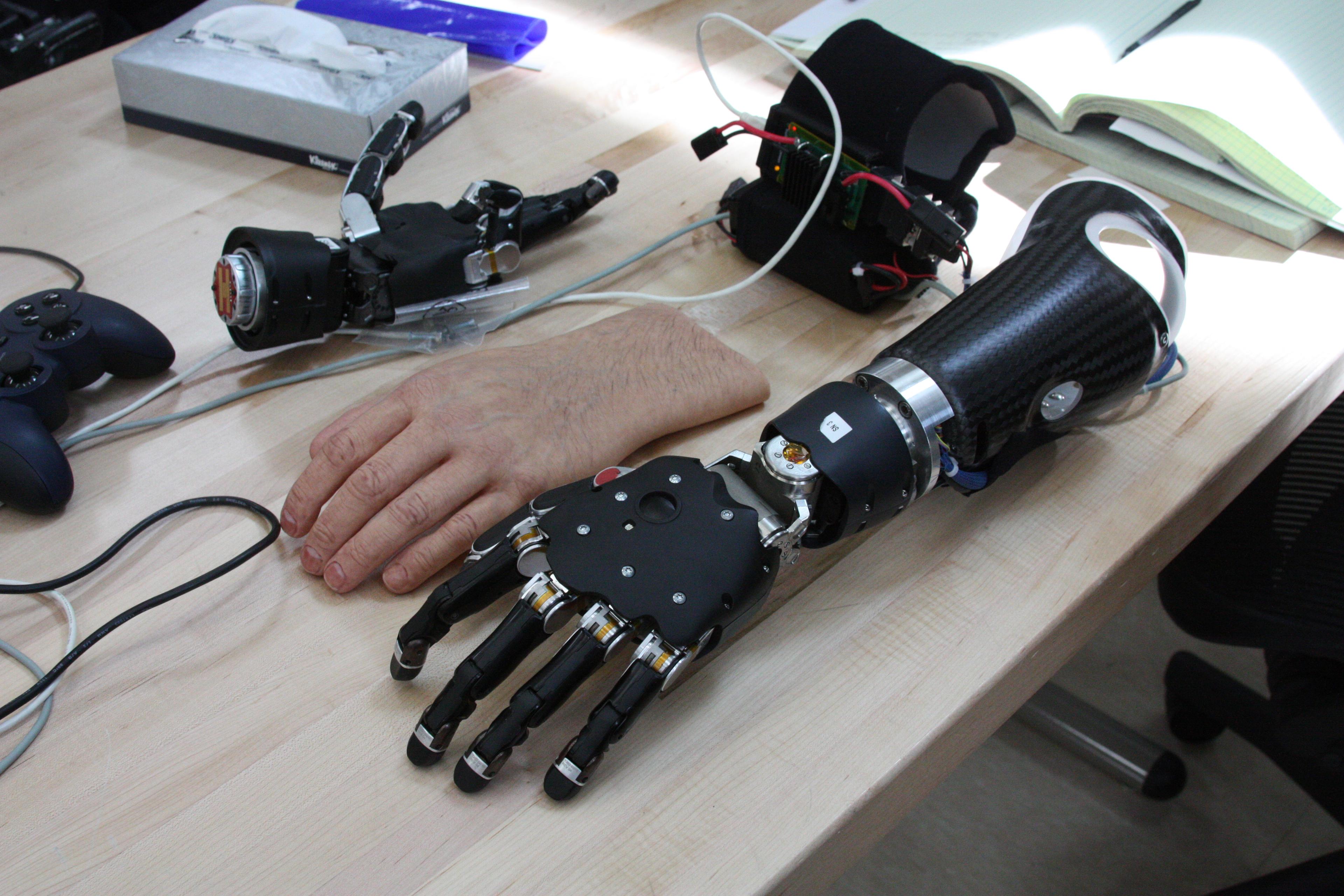 Researchers Map Brain Activity to Improve Prosthetic Design - Medical ...