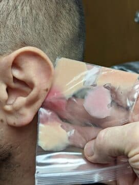 Realistic Prosthetic Ears by Artistic Anaplastologists