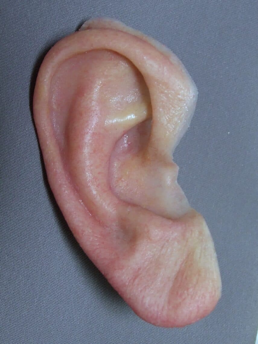 Realistic Prosthetic Ears by Artistic Anaplastologists