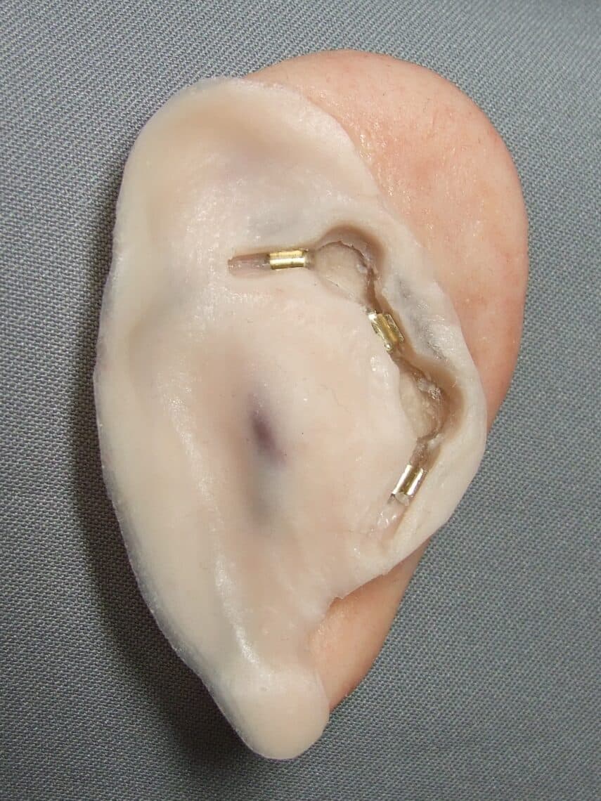 Realistic Prosthetic Ears by Artistic Anaplastologists