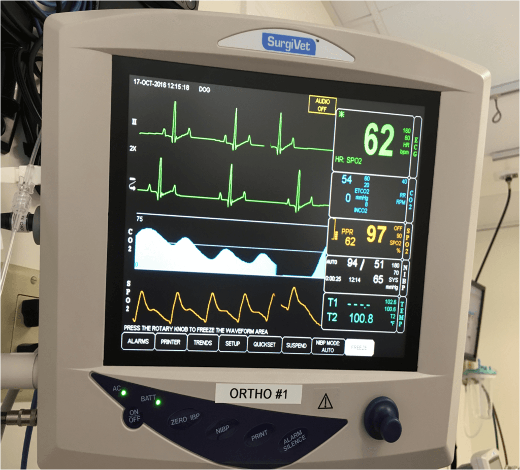 Riding The Wave Of Capnography: Understanding ETCO2, 60% OFF