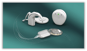 Choosing the Right Cochlear Implant System: Key Questions to Consider ...
