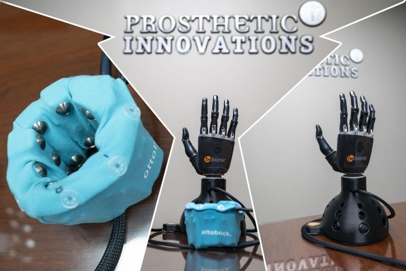 Ottobock Myo Plus | Prosthetic Innovations