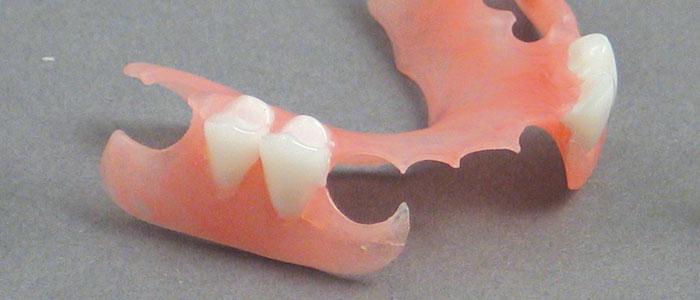 DuraFlex Flexible Partial Dentures at Wiand Dental Lab