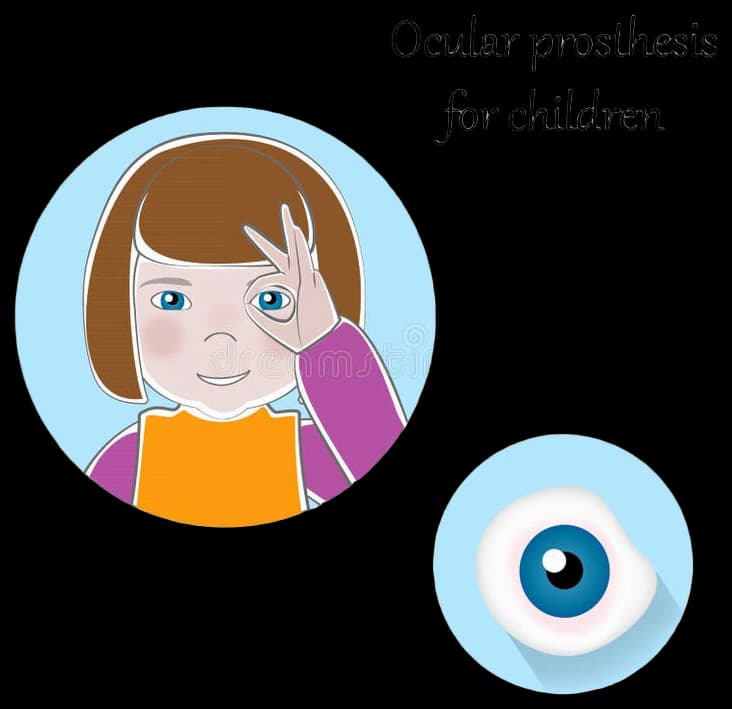 Custom Ocular Prosthetics