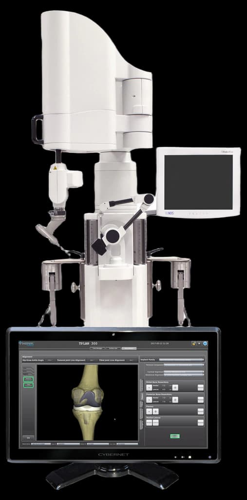 FDA OKs Think Surgical's TSolution One robotic knee surgery system