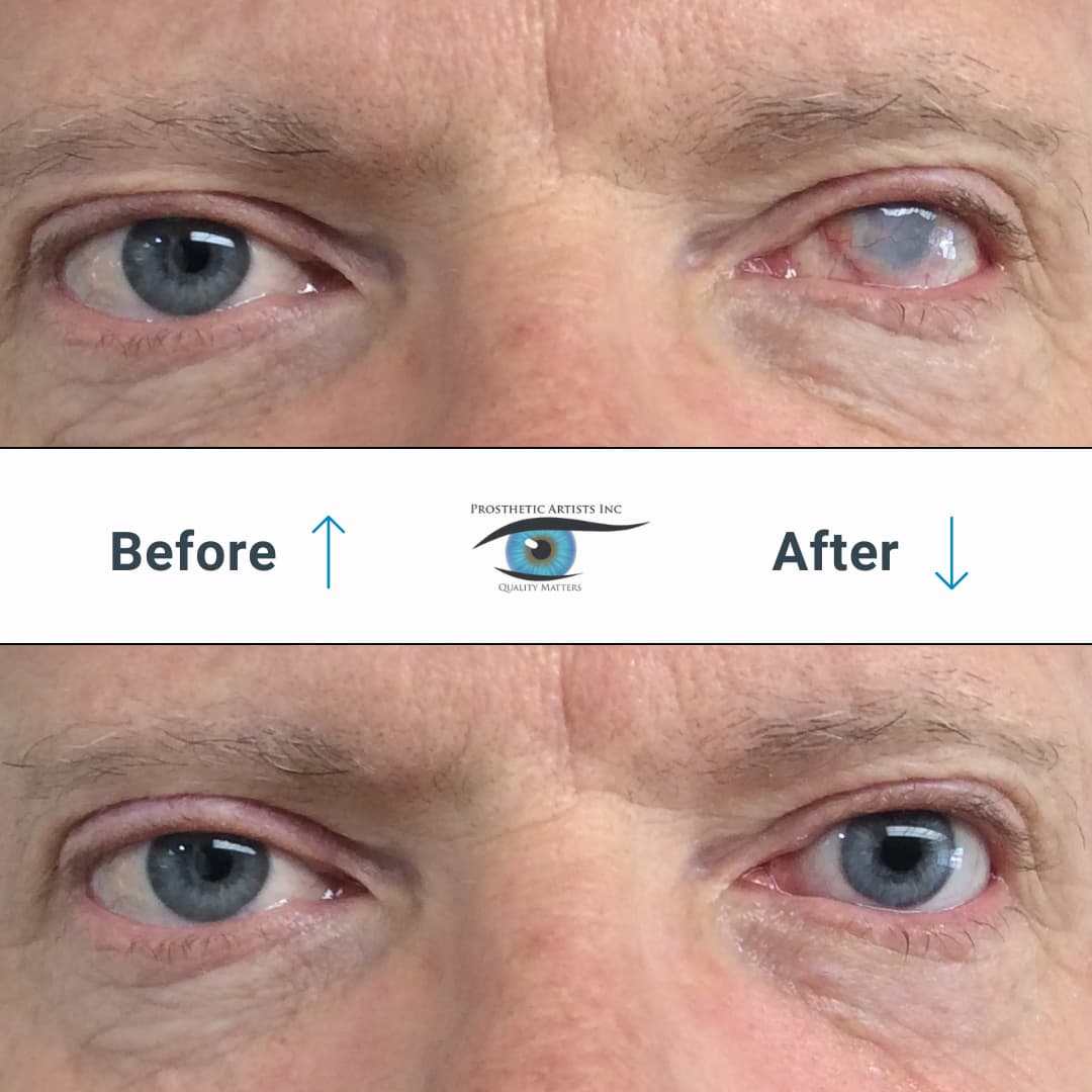 Prosthetic Artists Inc - Custom Facial & Ocular Prosthetics