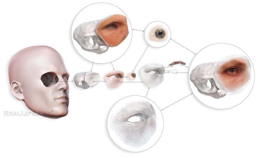 Eye | Reallifefaces Alloplastic Reconstruction Artificial Eye Clinic