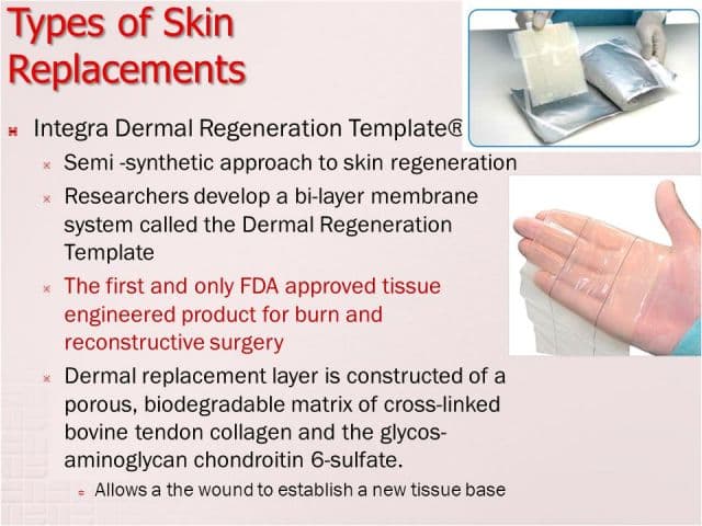 Integra Dermal Regeneration Template Wound Dressing Artificial Skin Ppt ...